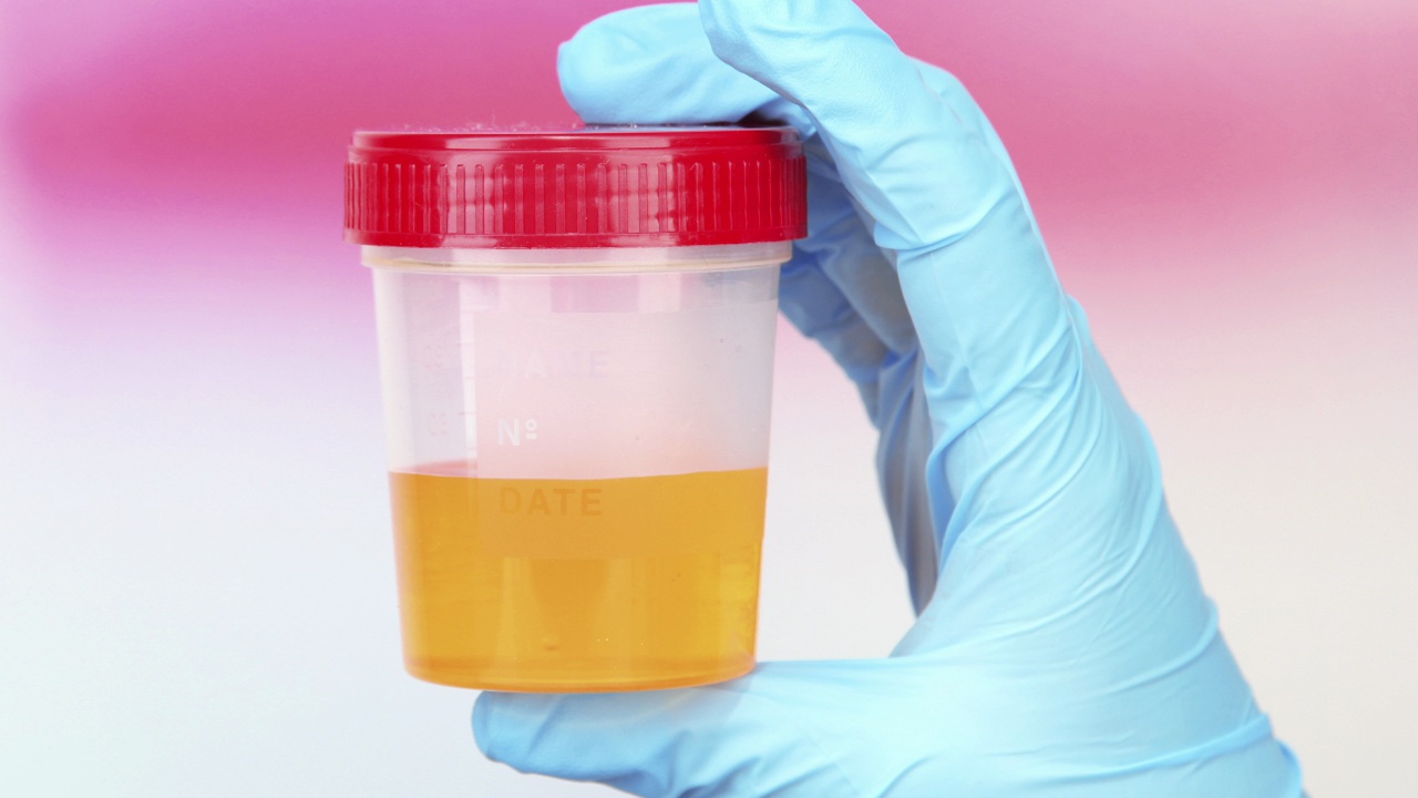 Synthetic Urine